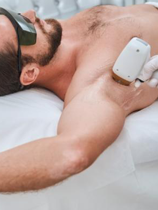 Erkek Lazer Epilasyon 5 men hair laser epilation