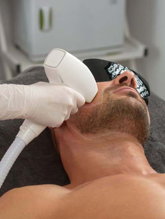 Erkek Lazer Epilasyon 6 men hair laser epilation