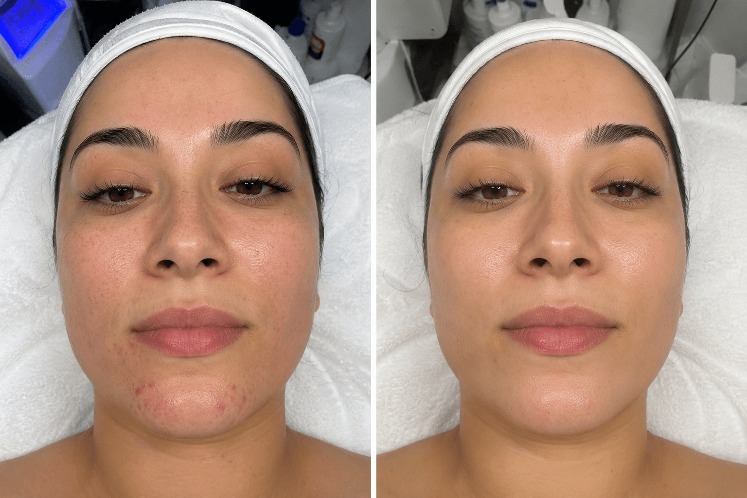 beforeafter3